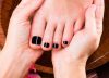 black toenail1